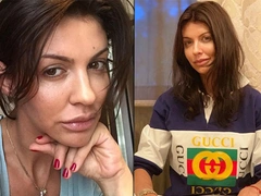 «Некроз развился за считаные месяцы»: Алиса Казьмина откровенно рассказала о ходе болезни