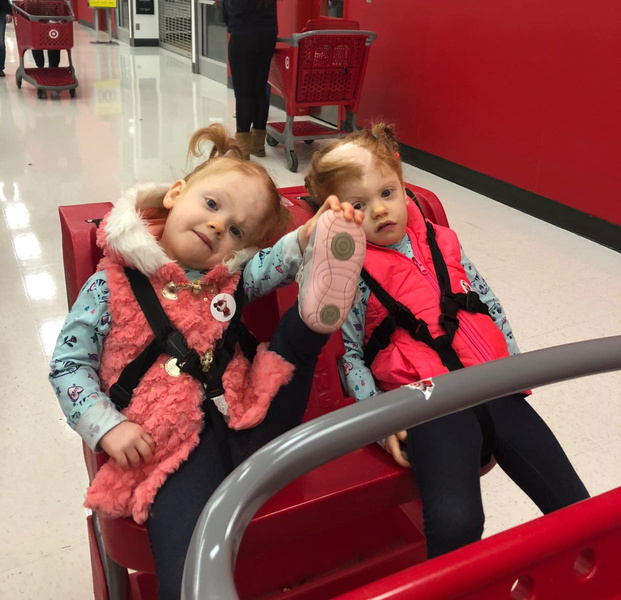 Рыжики-сестры: как живут близнецы, разделенные в 2017 году