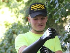 «Их надо принять как свои»: блогер Игорь Кошкин, потерявший все конечности, о жизни с протезами
