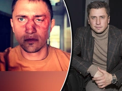 «Все версии интереснее правды»: Павел Прилучный вышел на связь после слухов об избиении
