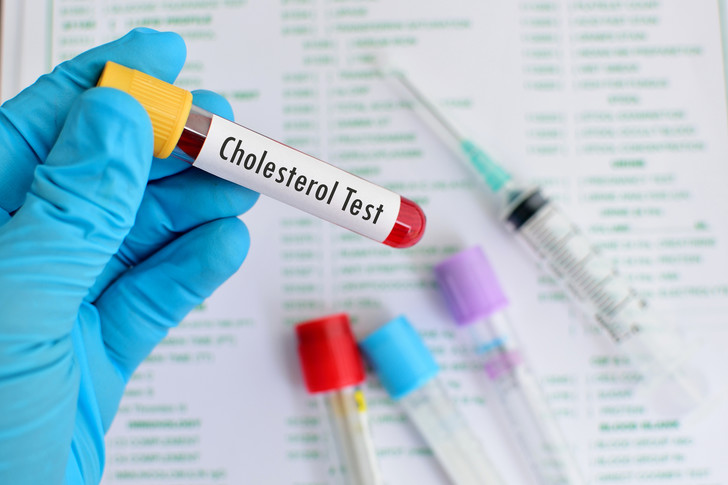 Повышенный холестерин может быть наследственным заболеванием