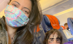 Девочке с «маской Бэтмена» срочно нужна операция — семья летит в Россию