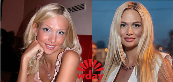 Юлия михальчик до и после пластики фото