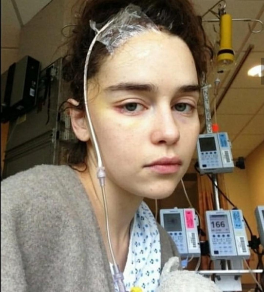 Эмилия Кларк опубликовала свои фото после инсульта