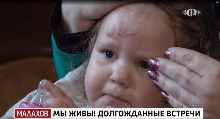 «Я хочу жить»: истории детей Донбасса, которые вырвались из ада