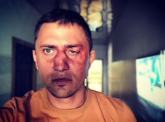 Павел Прилучный стал фигурантом уголовного дела после кровавой драки