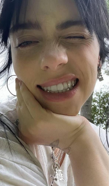 Блестящая улыбка: Билли Айлиш похвасталась модными скайсами на зубах