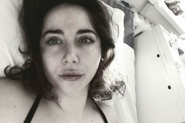 Олеся Лисовская сделала фото сразу после операции | Источник: Instagram (запрещенная в России экстремистская организация)