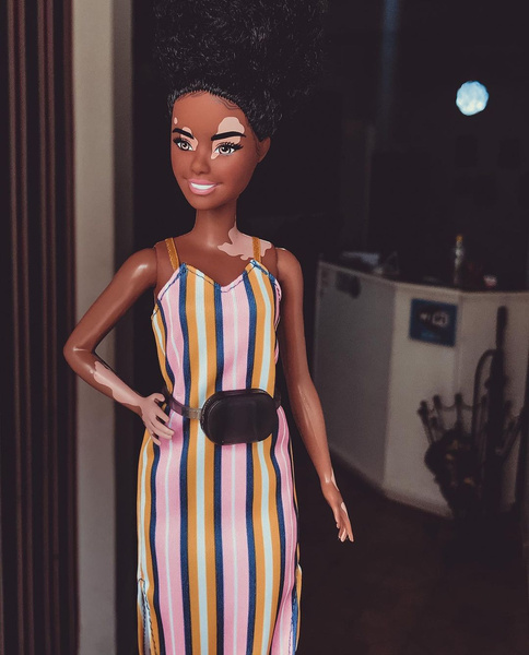 Многообразие красоты: Mattel выпустили кукол Барби с протезами конечностей