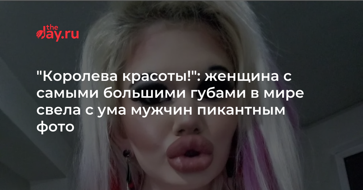 «Завидуйте!»: женщина-утка с самыми большими губами в мире свела с ума ...