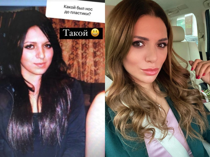 Невеста шеф-повара Константина Ивлева Валерию Куденкову показала фото как выглядела до пластической операции: фото до и после