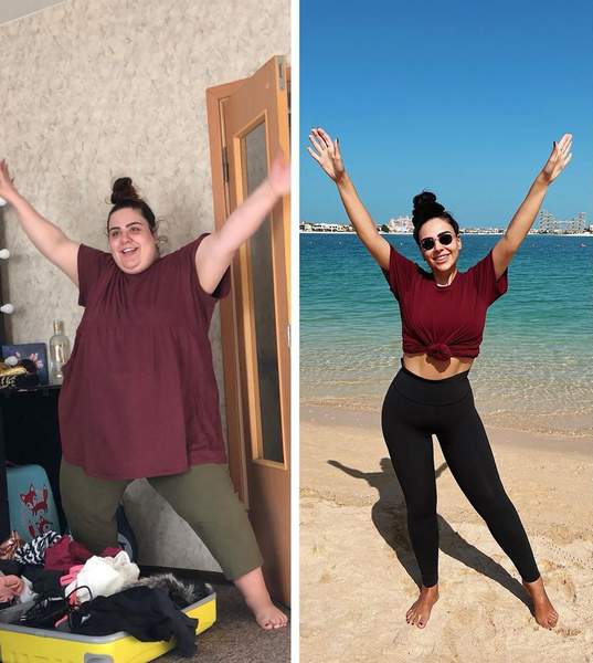 «Мне срезали 5 кг кожи»: блогерша показала фото до и после экстремального похудения