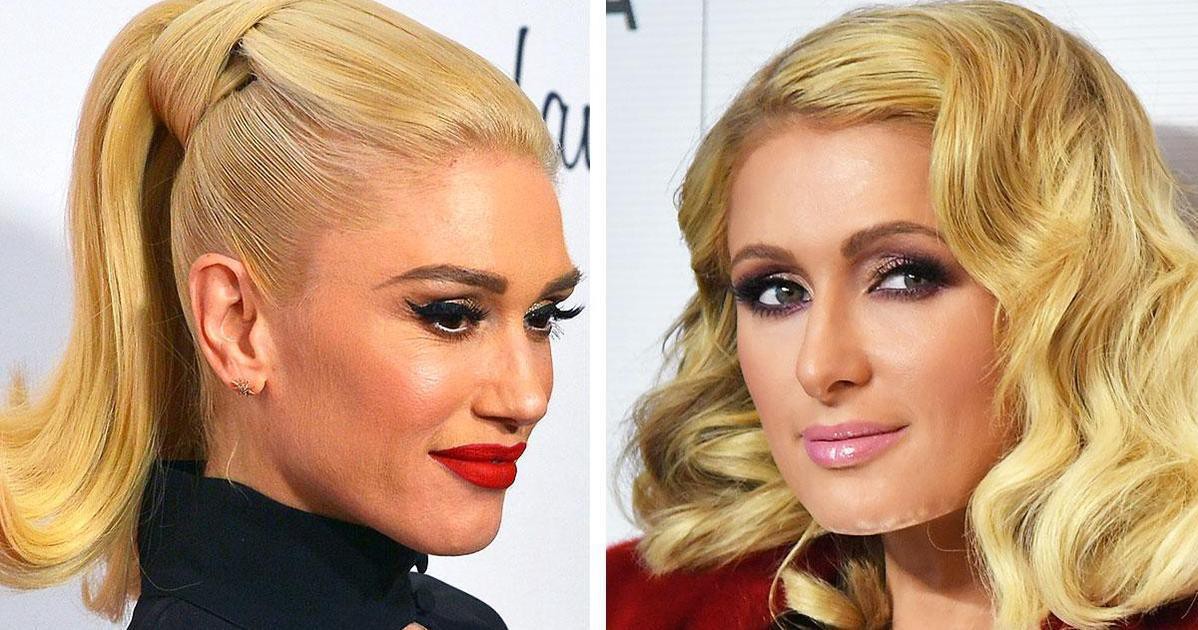 Не надо так: 7 звезд с неудачным желтым блондом | MARIECLAIRE