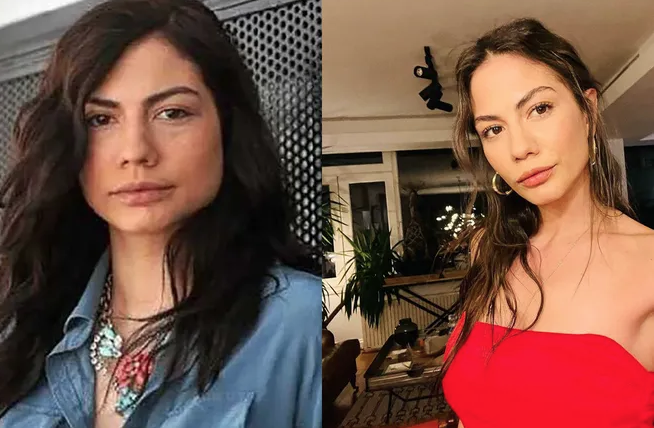 Как выглядят топовые турецкие актрисы до и после пластики