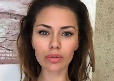 Виктория Боня поставила брекеты