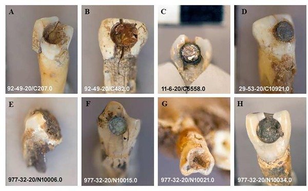 Гарантия — тысяча лет: уровень стоматологии у древних майя восхитил археологов