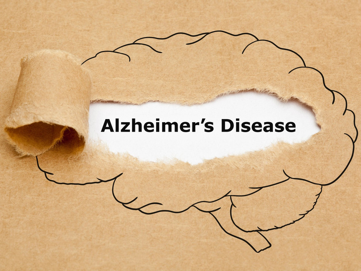 Без паники: что нужно делать сейчас, чтобы предотвратить болезнь Альцгеймера в будущем