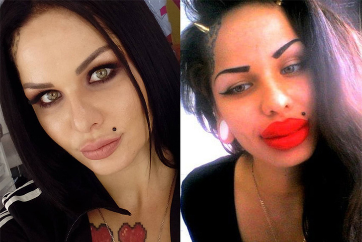 До и после: 15 девушек, которые зря накачали губы