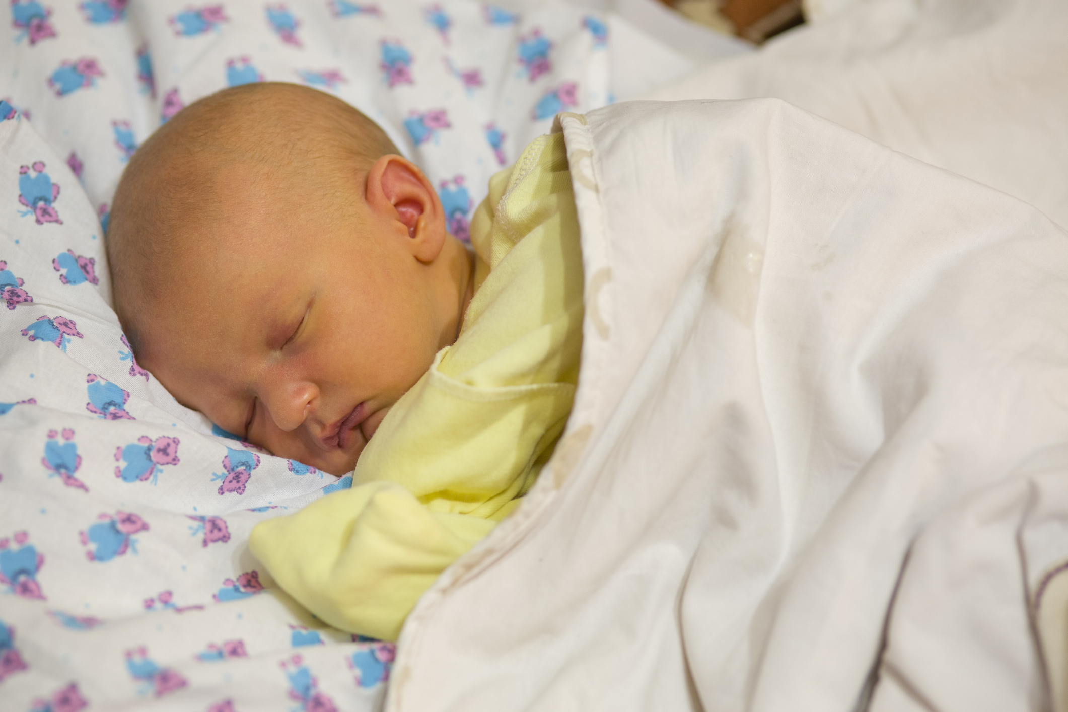 Как лечить физиологическую желтуху новорожденных