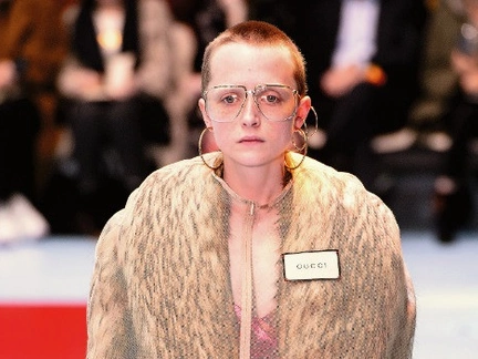 Студентка стала моделью Gucci после удаления опухоли мозга