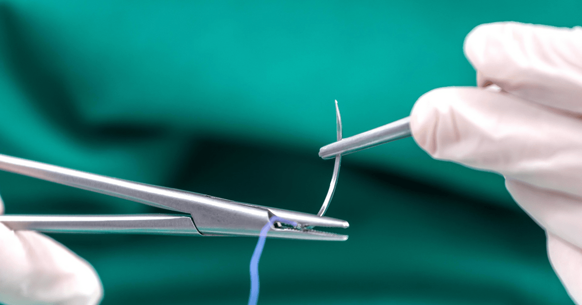 Пролиферативная фаза