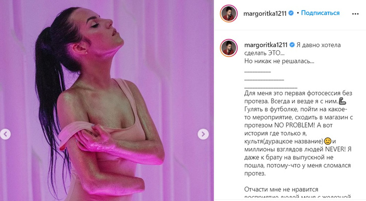 Без протеза и в боди: Маргарита Грачева снялась в смелой фотосессии