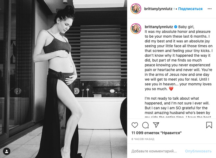 Жена звезды фильма «Сумерки» Келлана Латса потеряла ребенка на 6-м месяце беременности