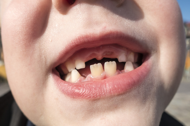 коренные зубы у ребёнка
