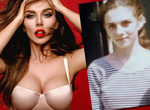 Анна Седокова До Пластики И После Фото