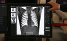 Экзоскелет, инсулиновая помпа и рентгенаппараты: что нового производят в России для медиков