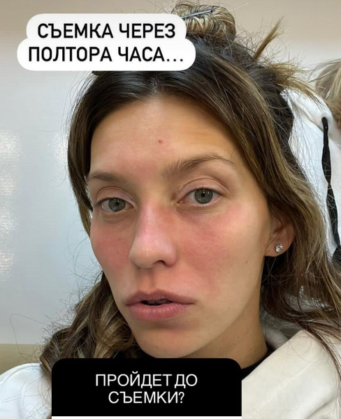 Разведенная Mary Gu подтвердила роман с Драгни, лицо Тодоренко пострадало от аллергии. Соцсети звезд