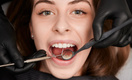Болезнь XXI века: почему зубы больше 90% людей на Земле разрушает кариес