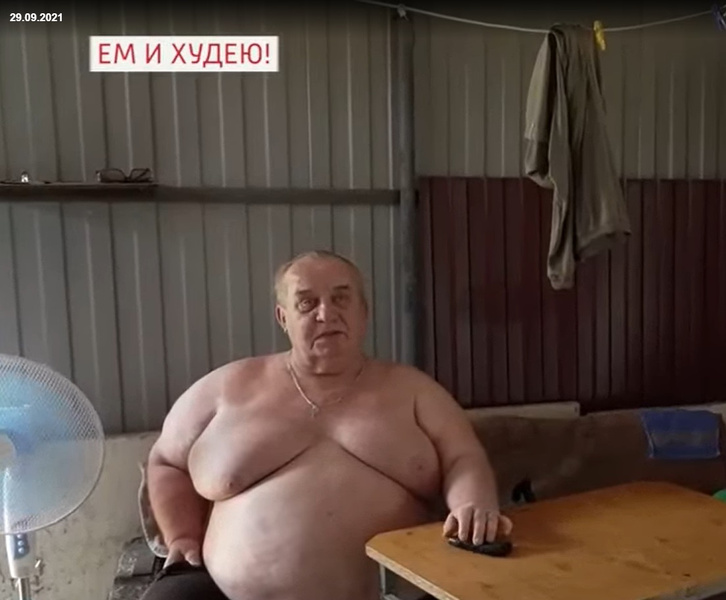Страдающий ожирением человек-гора из Ростовской области сделал операцию на желудке