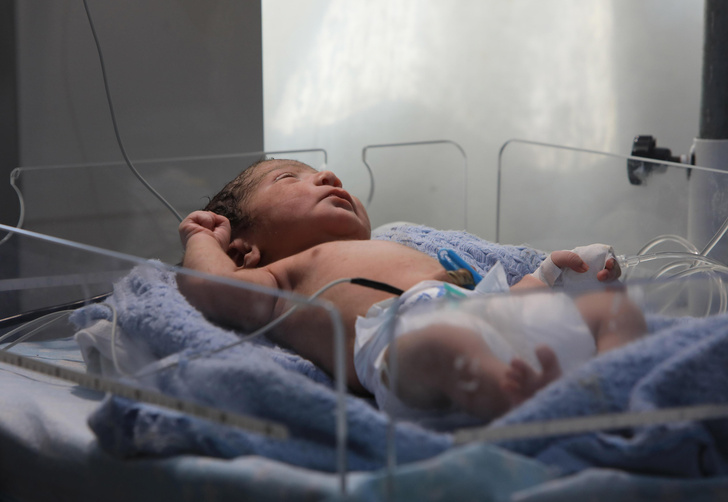 Жизнь вопреки смерти: под завалами Алеппо родился ребенок