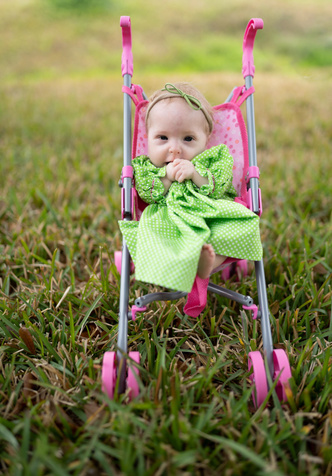 Фото №3 - 2-летняя девочка с редкой болезнью весит 3 кг и носит одежду для новорожденных