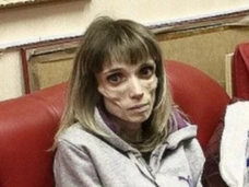 Весила всего 17 кг. Как сегодня выглядит победившая анорексию Кристина Корягина