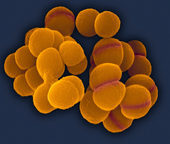 Deinococcus radiodurans | Источник: DENNIS KUNKEL MICROSCOPY/SCIENCE PHOTO LIBRARY / Legion-Media