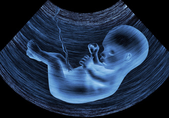 Еще не родился, а уже веган: зачем в Англии накормили эмбрион в утробе морковью и капустой