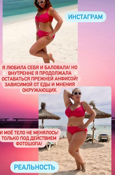 Анфиса Чехова раскрыла, как нещадно фотошопила жир