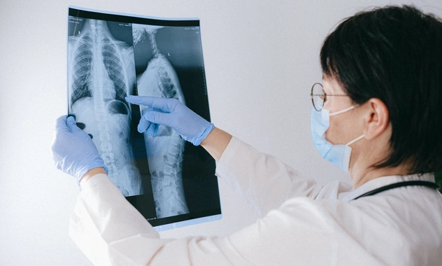 Пульмонолог Пурясев объяснил, почему поражение легких подолгу не замечают