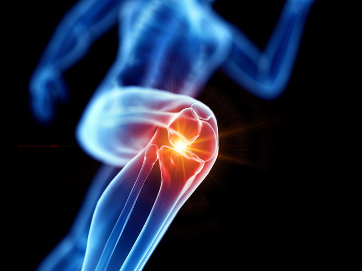 Фото №1 - Воспаление колена: причины, симптомы и лечение