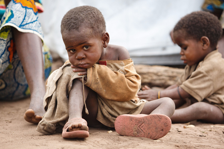 Не порок, но проблема: 10 самых бедных стран мира