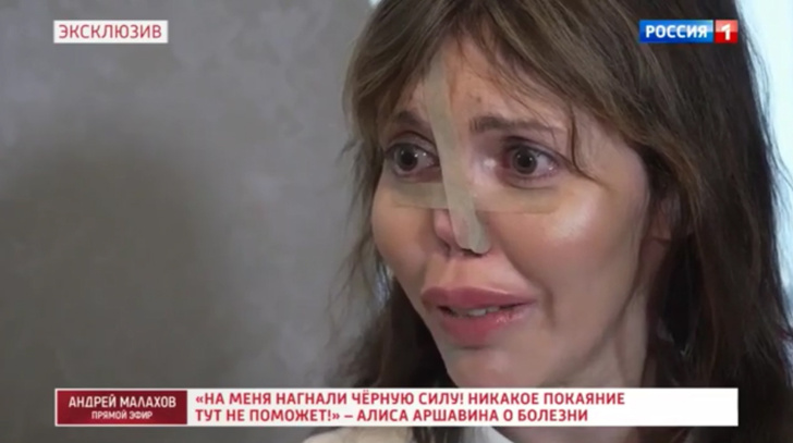 Физиогномист указал на пять точек на лице Казьминой, говорящих о том, что ее нужно срочно спасать