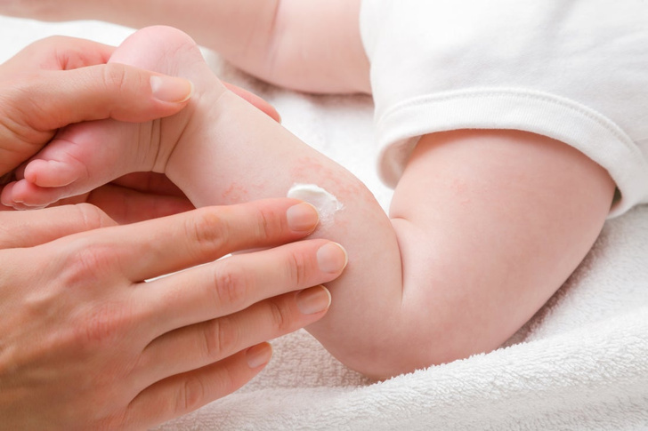 как ухаживать за кожей новорожденного ребенка
