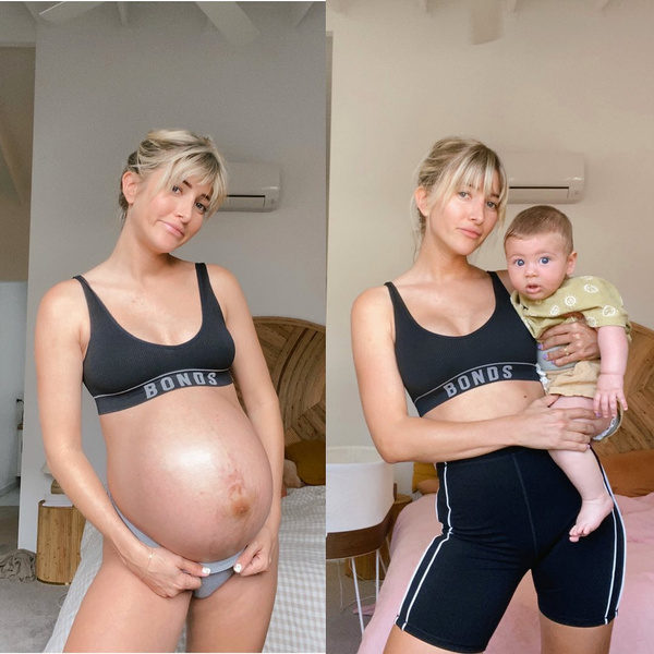 фигура после родов, живот после родов фото, до и после, восстановление после родов