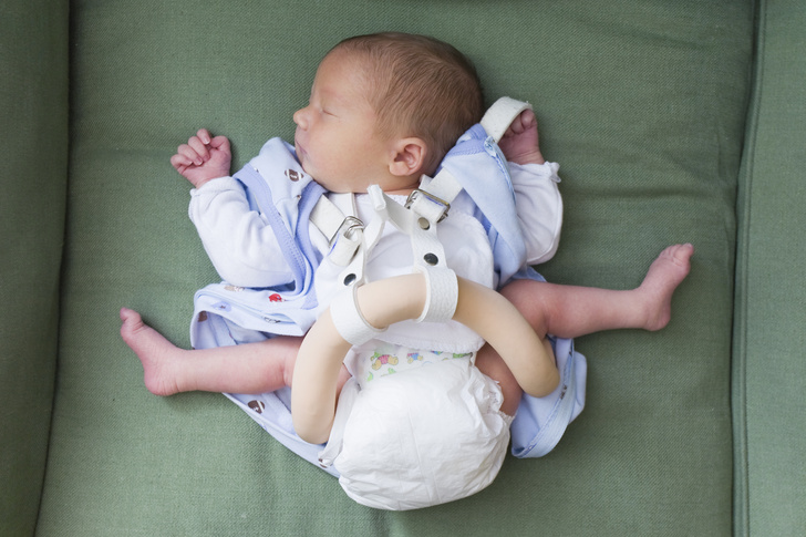 незрелость суставов у новорожденных