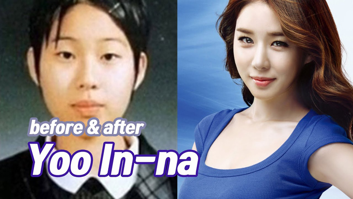 Ты не поверишь этим фото: 10 корейских звезд до и после пластики