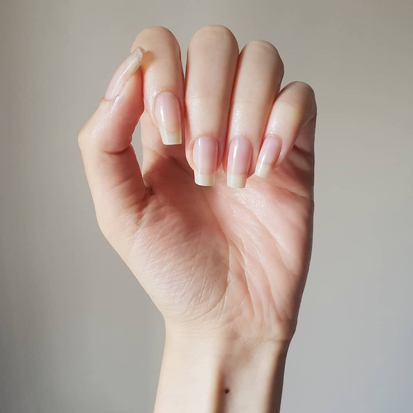 Лейконихия - Белые пятна на ногтях: что означают, как их убрать?