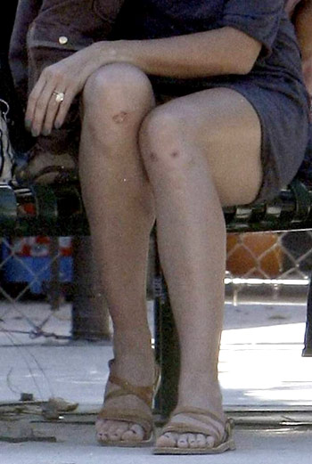 У Хайди Клум поцарапанные коленки