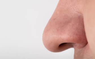 Правда ли, что нос у человека растет всю жизнь?